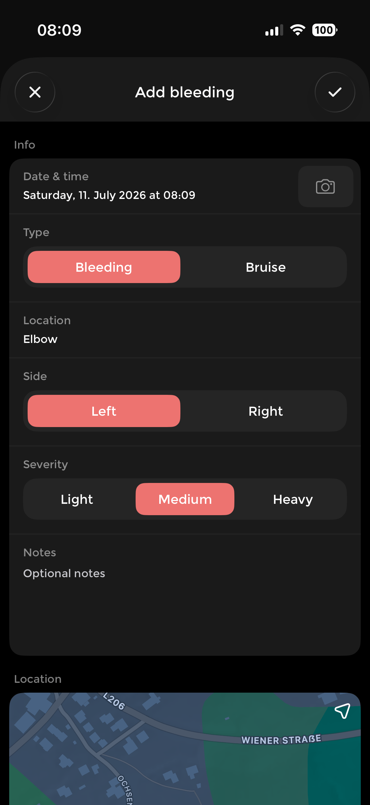 Add bleeding screen with date, type (bleeding or bruise), location, side, severity, notes, a camera button and a map of where it happened.